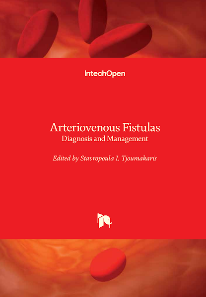 Sampul Arteriovenous Fistulas