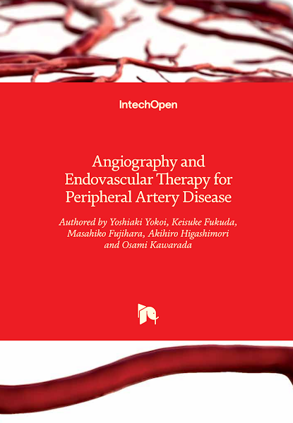 Sampul Angiography and Endovascular Therapy for Peripheral Artery Disease