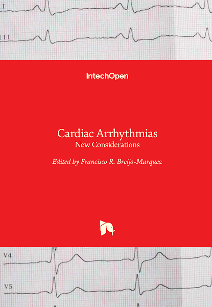 Sampul Cardiac Arrhythmias